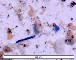 MICROPLASTICS